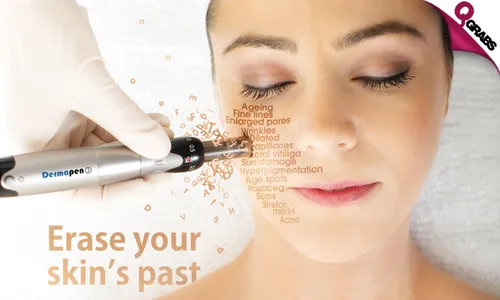 Dermapen & Acne Therapy Sessions!